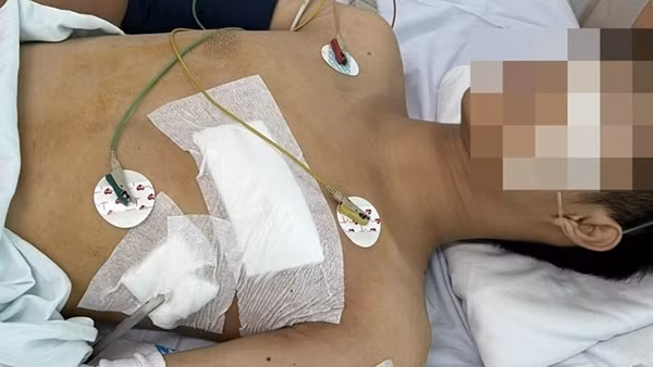 Cứu sống nạn nhân bị cá mập cắn ở vùng biển Bạch Long Vỹ ảnh 2
