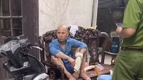 Chồng chém vợ trọng thương rồi ngồi "thần mặt" trên ghế salon