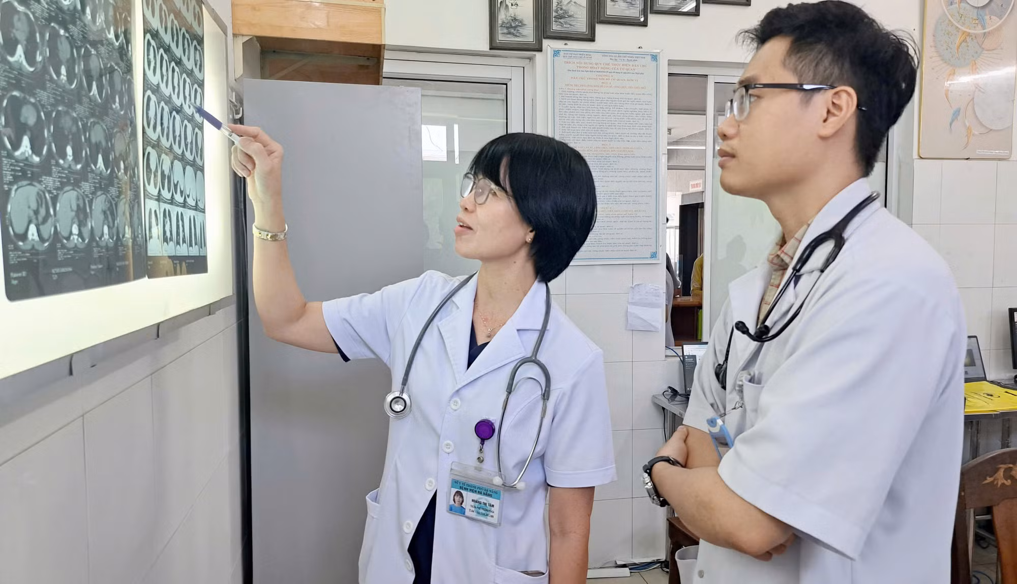 Lấy thành công xương cá dài hơn 1,5cm sau 5 tháng “trú” trong phế quản bệnh nhân -0