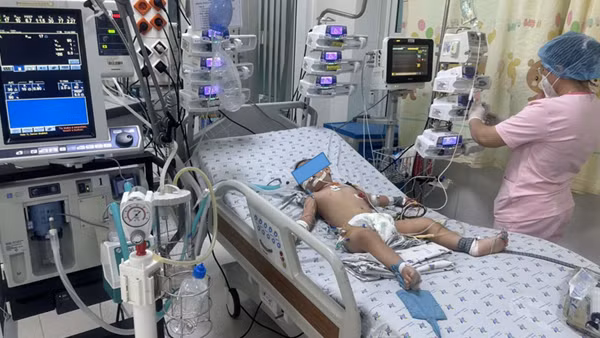 TP Hồ Chí Minh: Ba kịch bản ứng phó với dịch bệnh tay chân miệng đang gia tăng