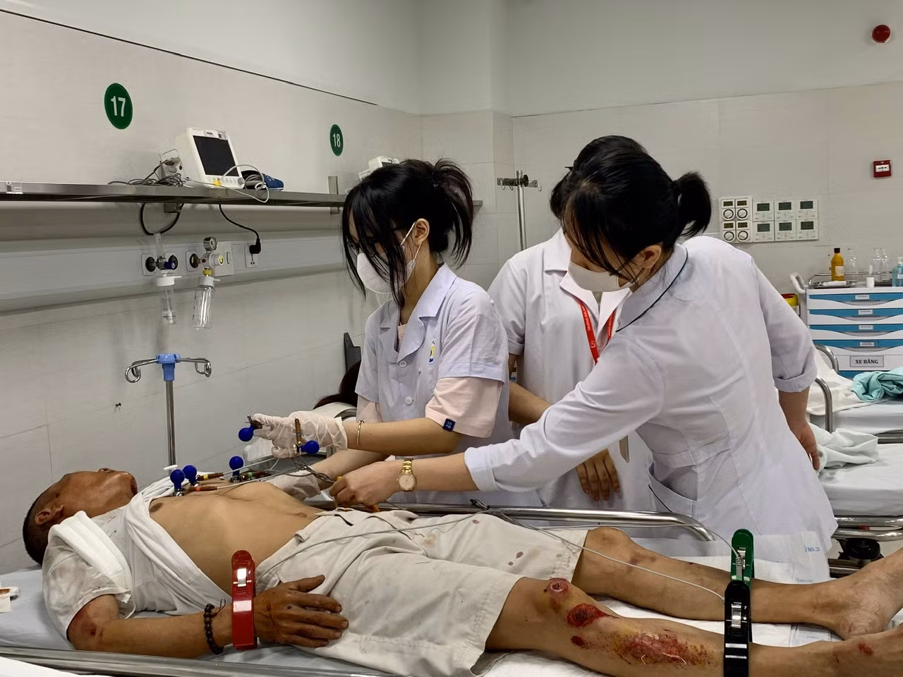 Nhiều ca cấp cứu trong 5 ngày nghỉ lễ -0
