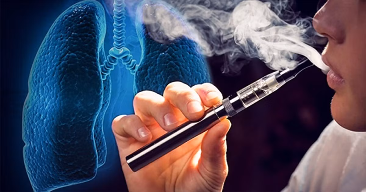 Bộ Công Thương kiến nghị chưa cho phép lưu hành thuốc lá điện tử -0