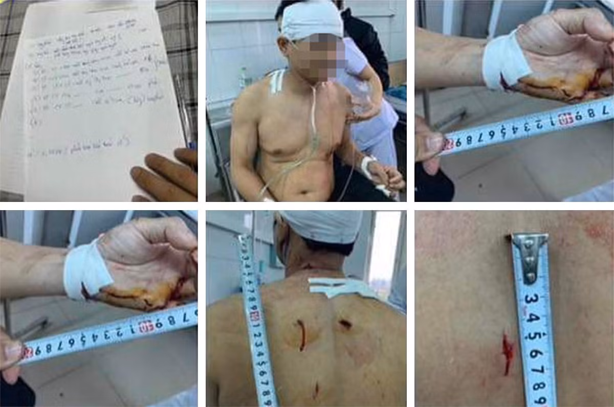 Đối tượng đâm trọng thương Phó Chánh án huyện liên quan đến một vụ TNGT -0