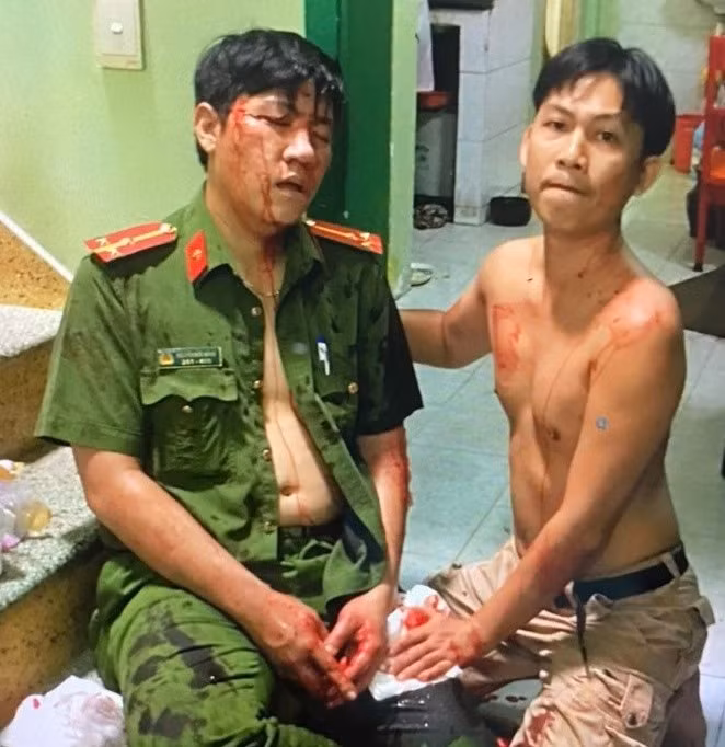 Cảnh sát khu vực bị thương tích nặng do đối tượng nghiện tấn công bất ngờ -0