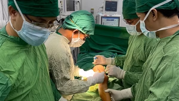 Phẫu thuật thành công một bệnh nhi xương thủy tinh