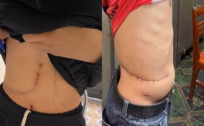 Ghép tạng giữa lằn ranh luật pháp -0