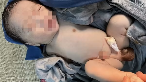 Bé trai sơ sinh nặng 3kg bị bỏ rơi