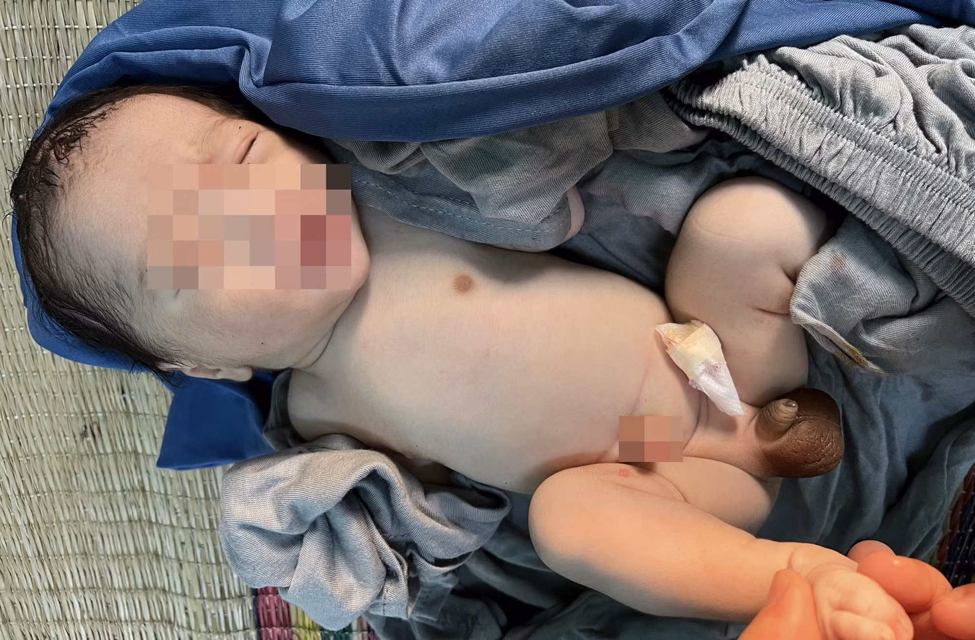 Bé trai sơ sinh nặng 3kg bị bỏ rơi -0