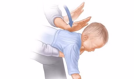 Bé gái 2 tháng tuổi tử vong nghi ngạt sữa -0