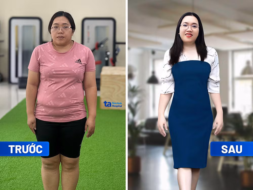 Giảm cân dễ dàng, an toàn với mô hình chuẩn y khoa quốc tế -1