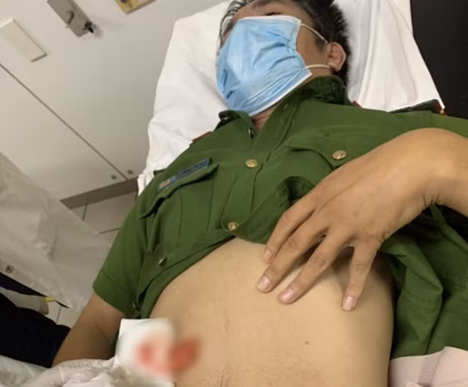 Một cán bộ Công an xã bị côn đồ đâm trọng thương khi đang làm nhiệm vụ -0