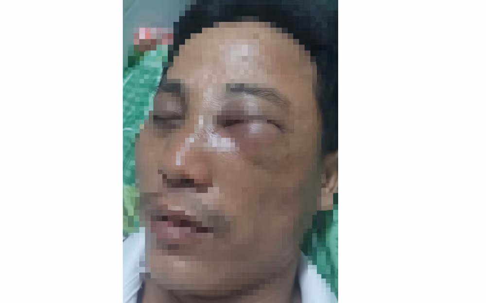 Xử lý nghiêm đối tượng hành hung Phó Hiệu trưởng Trường PTTH Hàm Tân, Bình Thuận -0