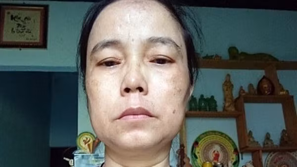 Nữ chủ hụi trốn truy nã 26 năm bị bắt