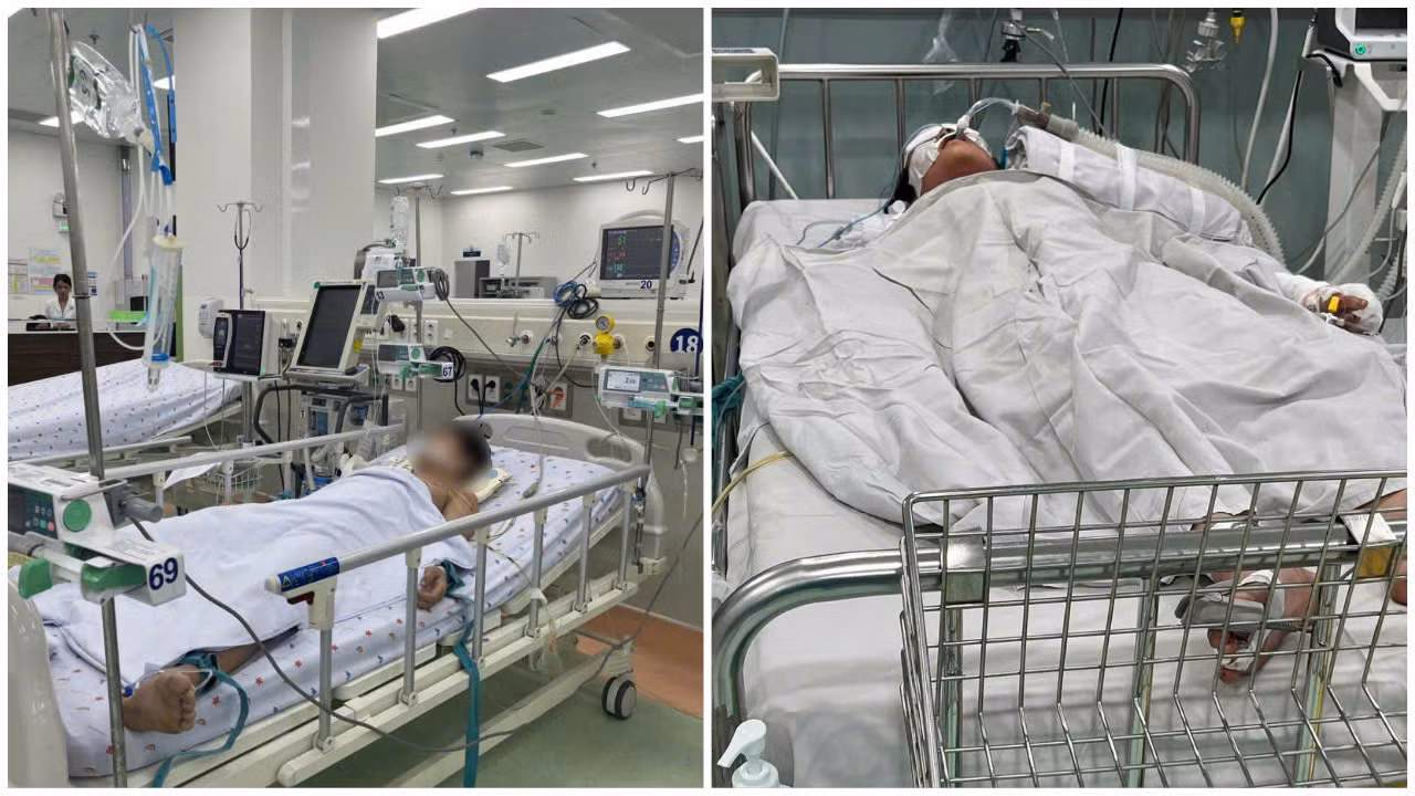 Vụ cháy tiệm bánh kem lúc rạng sáng: Nhiều bệnh nhân phải thở máy -0