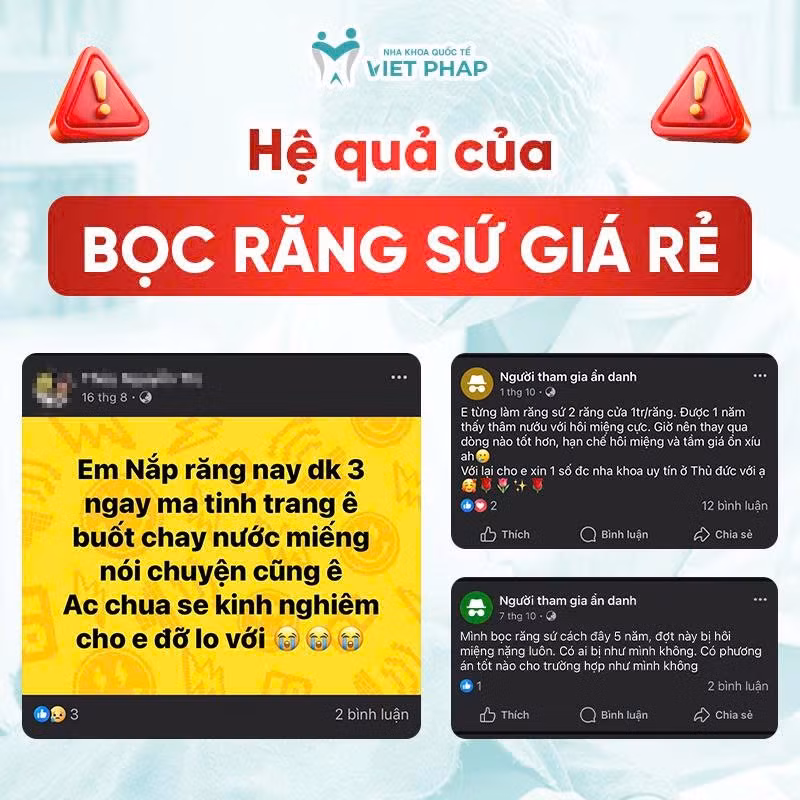 Bọc răng sứ đón Tết – làm đúng để không “mất Tết” -0