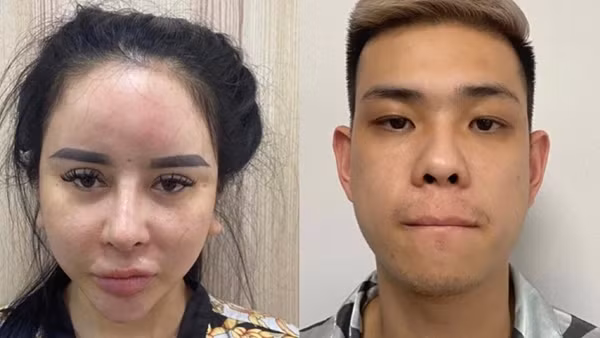 Mua ma túy ở Biên Hòa rồi thuê xe trở về Phan Thiết bán ảnh 2