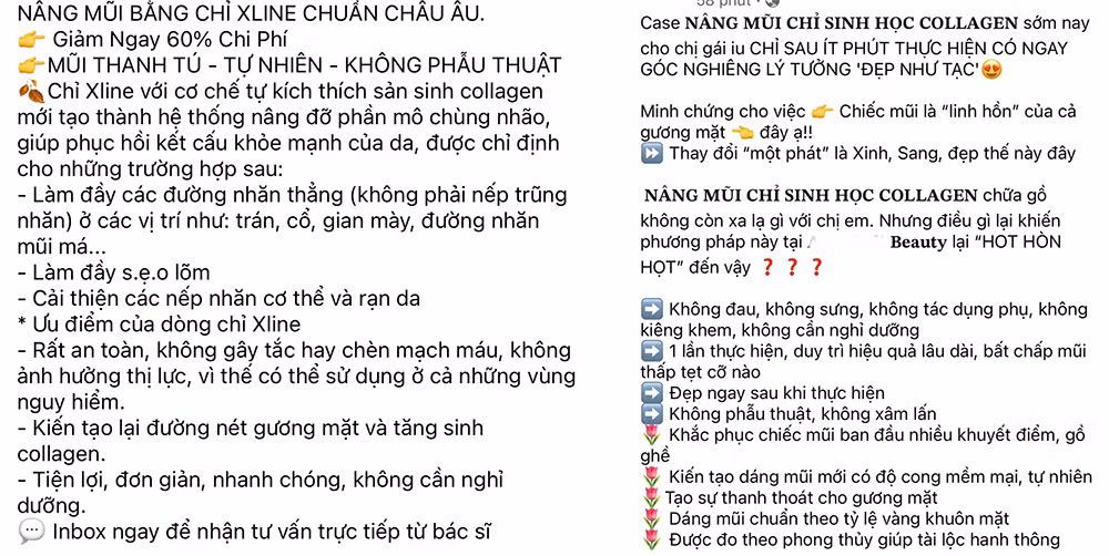 Gặp họa vì nâng mũi chỉ sinh học collagen -0