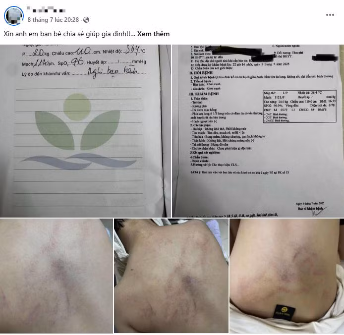 Tạm đình chỉ 2 cô giáo nghi bạo hành trẻ mầm non ở Bồ để điều tra -0