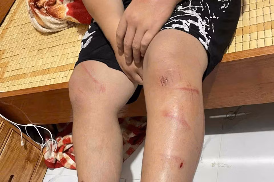 Điều tra vụ việc nam sinh lớp 8 bị hàng xóm xích chân, đánh đập -0
