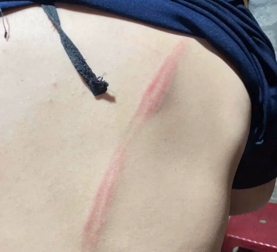 Điều tra vụ việc nam sinh lớp 8 bị hàng xóm xích chân, đánh đập -0