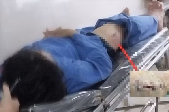 Điều tra vụ cán bộ Cục Thuế bị kẻ bịt mặt dùng dao đâm -0