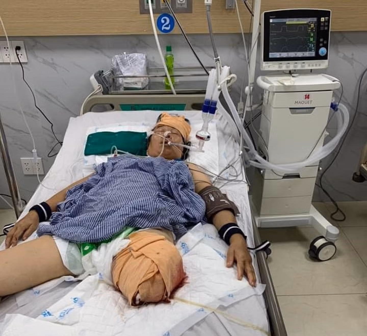 Lái xe là quân nhân gây tai nạn nghiêm trọng ở Hải Phòng -0