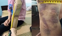 Đánh vợ, người đàn ông bị Chủ tịch tỉnh phạt 15 triệu đồng -0