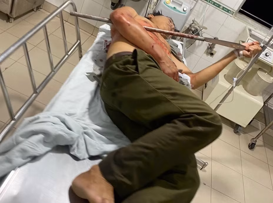 Tổ trưởng dân phòng bị trọng thương khi ngăn chặn 2 nhóm thanh niên đi hỗn chiến -0