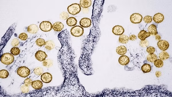 Ổ dịch virus Hanta trên tàu du lịch Đại Tây Dương tăng lên 8 ca, WHO đang truy vết