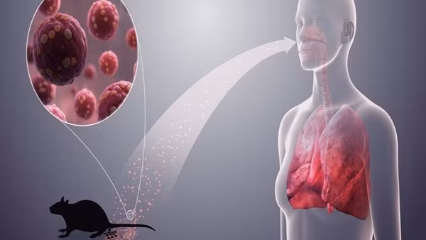 Bộ Y tế cảnh báo khẩn về loại virus lây từ chuột sau chùm ca bệnh tử vong trên tàu du lịch