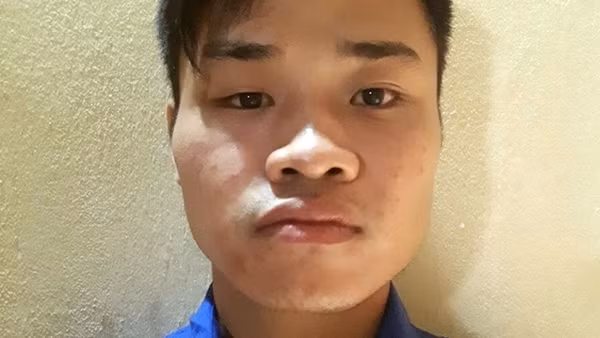 Giết người rồi tẩu thoát bằng ô tô