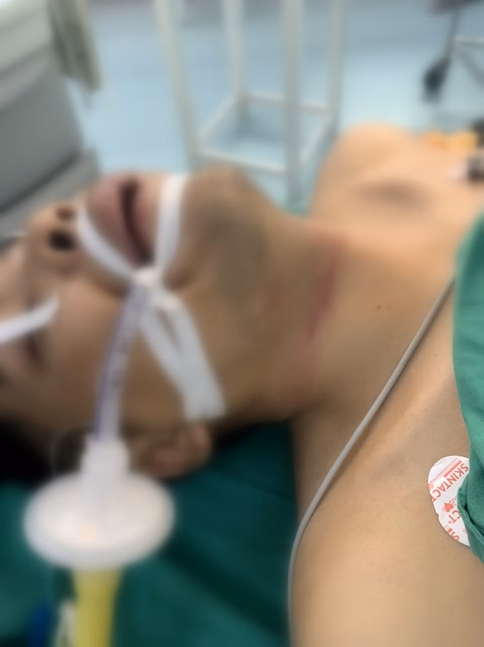 Sát hại vợ rồi tự tử bất thành -0