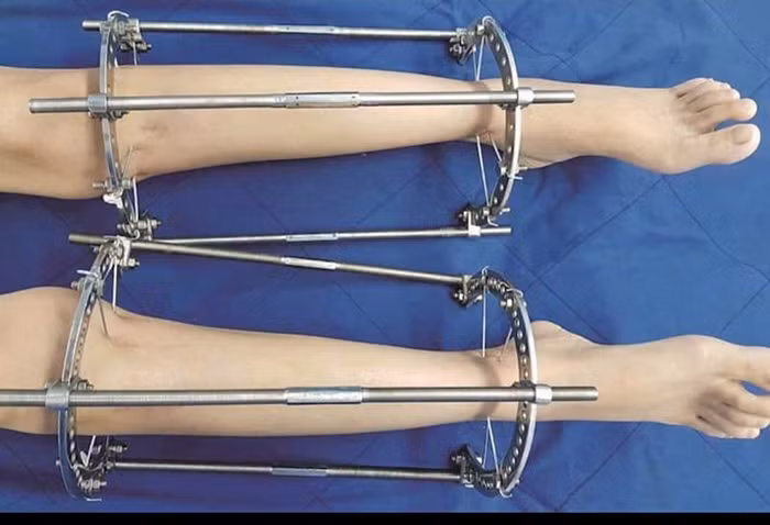 Bi kịch từ khát vọng… chân dài -0