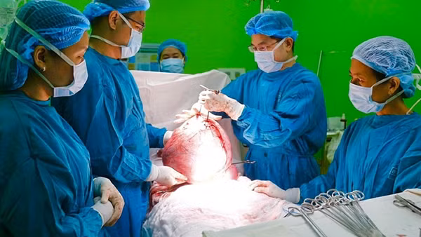 Phẫu thuật cứu người phụ nữ mắc bệnh "bướu con bò" hiếm gặp ảnh 3