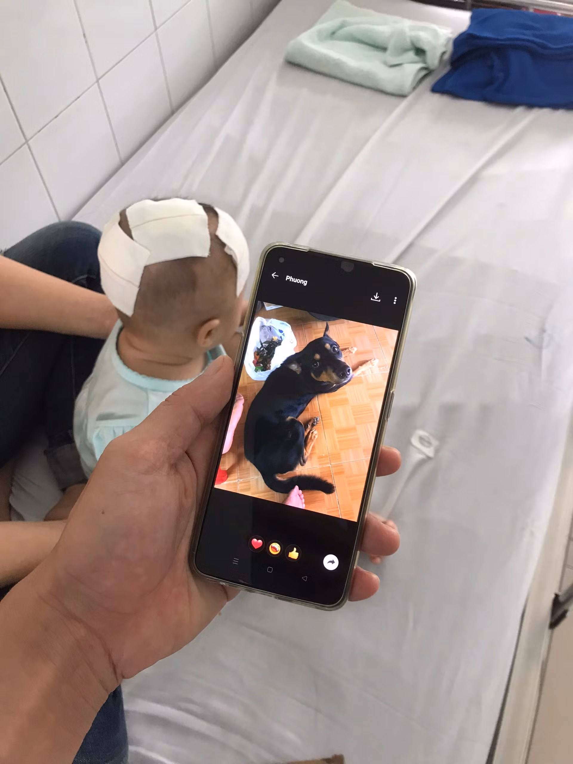 Chọc giận thú cưng, em bé bị chó cắn xuyên sọ -0