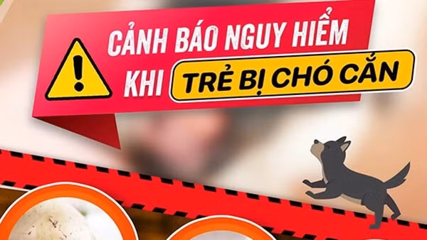 Bé trai phát bệnh dại nguy kịch sau khi bị chó nhà cắn 1 tháng