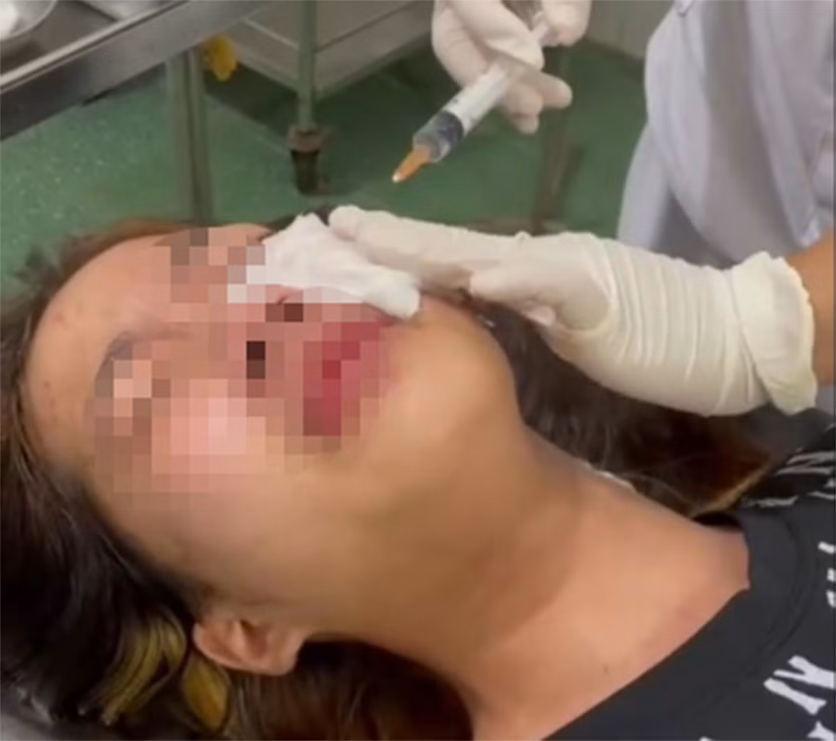 Điều tra vụ việc nhóm nam thanh niên xịt hơi cay vào mặt nữ sinh -0