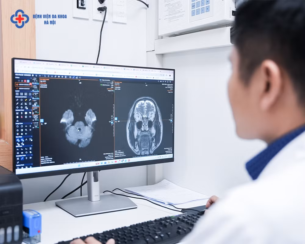 Phát hiện tắc nghẽn hoàn toàn động mạch cảnh, có nguy cơ đột quỵ bất cứ lúc nào dù không có triệu chứng báo trước -0