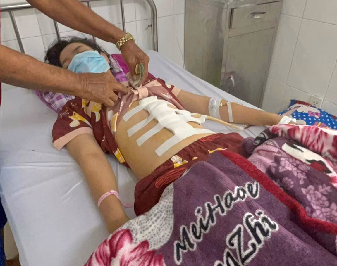 Sức khỏe thiếu nữ bị cha dượng đánh dập lá lách, gãy xương sườn đã ổn định -0