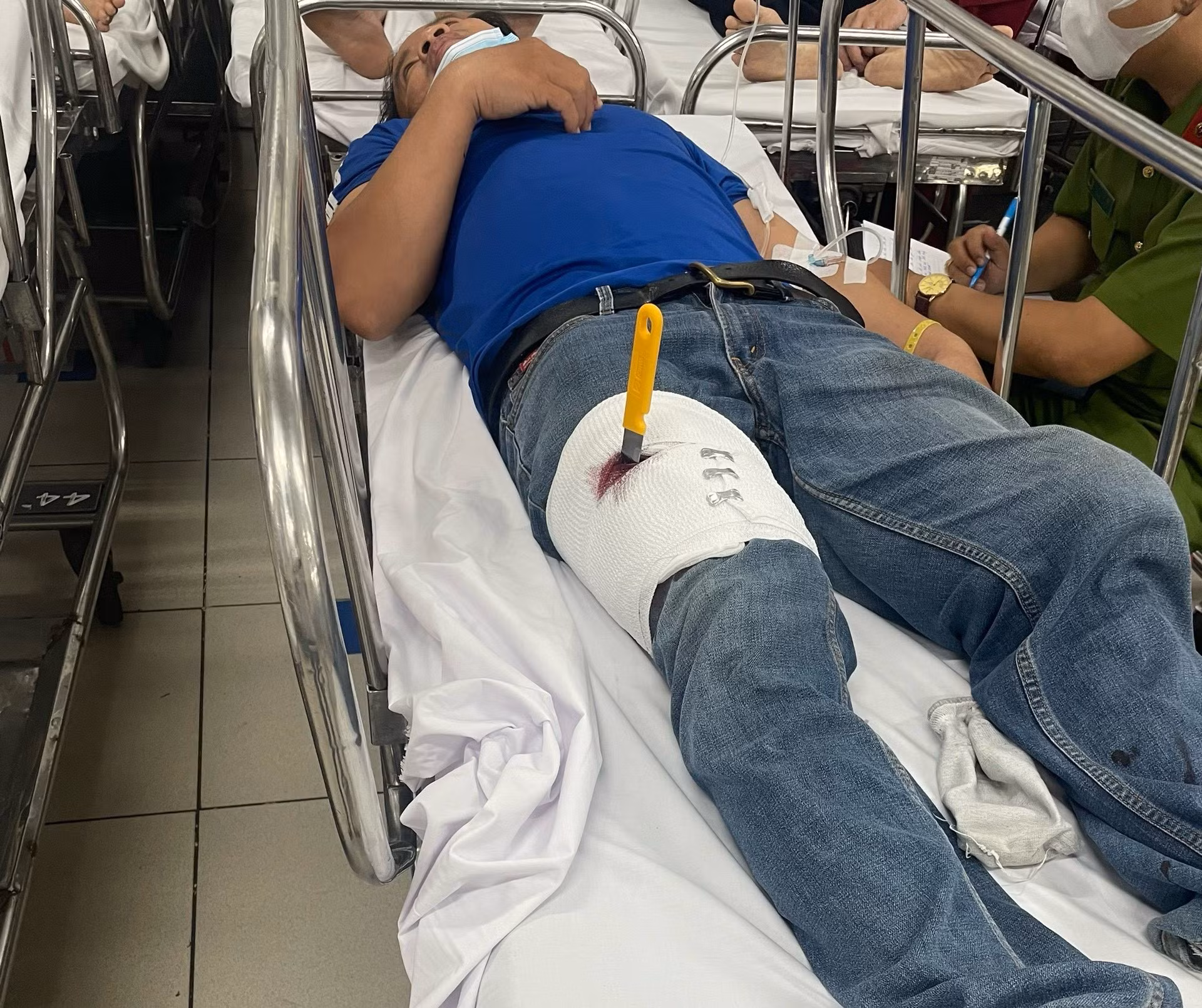 Giấu vợ đem tiền cho cha mẹ, người chồng tự đâm vào đùi, dàn cảnh bị cướp -0