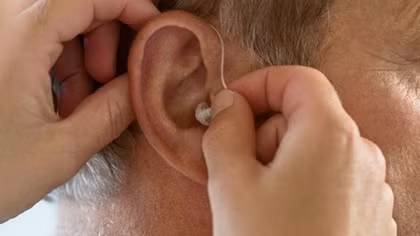 Người đàn ông suýt bị điếc vì... quên bông 2 năm trong tai