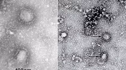 Australia đạt đột phá, kì vọng sắp có vaccine chống virus corona