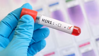 Dịch cúm H1N1 quay lại, 56 người thiệt mạng ở Đài Loan