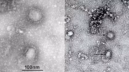 Người đầu tiên mắc viêm phổi Vũ Hán khỏi bệnh, thuốc HIV có thể ức chế virus