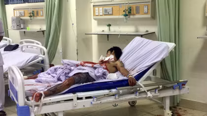 Nam thanh niên lên cơn “ngáo đá” tự cắt cổ, mổ ngực