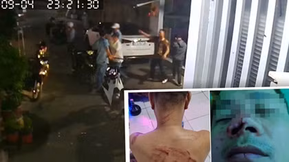 Hơn 10 đối tượng xông vào nhà đánh chém mặc gia đình van xin