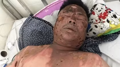 Hỏi tuổi bố bạn nhậu, bị hất cả nồi lẩu vào mặt