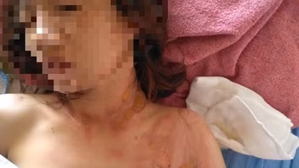 Đang đi đường, bị tạt xăng phóng hỏa