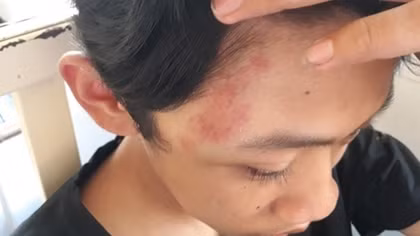 Nam sinh lớp 9 bị đánh hội đồng tới nhập viện