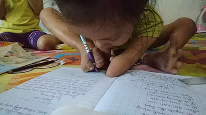 Nghị lực sống phi thường của cô bé "chim cánh cụt"